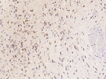 CXCL5 Rabbit Polyclonal Antibody