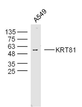 KRT81 Rabbit Polyclonal Antibody