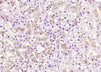 TBCE Rabbit Polyclonal Antibody