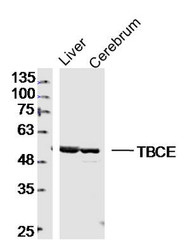 TBCE Rabbit Polyclonal Antibody