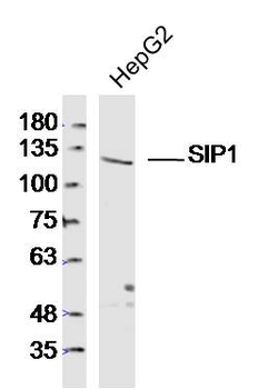 SIP1 Rabbit Polyclonal Antibody