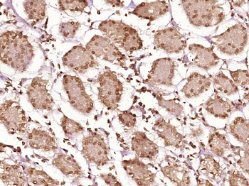 RBM15B Rabbit Polyclonal Antibody