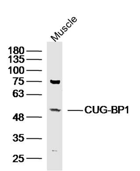 CUG-BP1 Rabbit Polyclonal Antibody