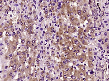 CCL15 Rabbit Polyclonal Antibody