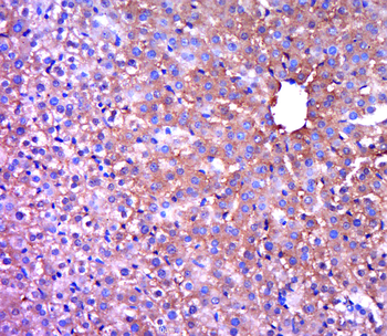 Galactosylceramidase Rabbit Polyclonal Antibody