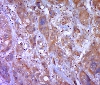 Caspase-12 Rabbit Polyclonal Antibody