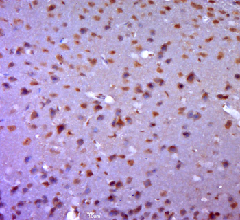 GDF8 Rabbit Polyclonal Antibody