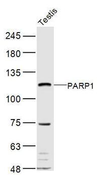 PARP1 Rabbit Polyclonal Antibody