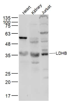 LDHB Rabbit Polyclonal Antibody