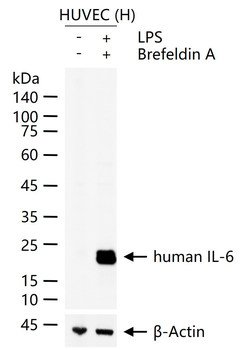 Human IL-6 Mouse Monoclonal Antibody