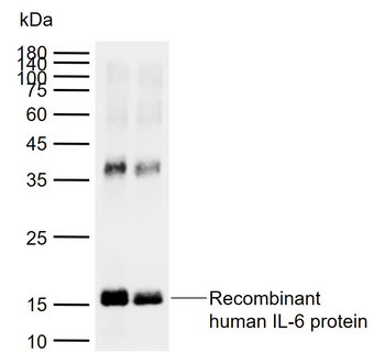 Human IL-6 Mouse Monoclonal Antibody