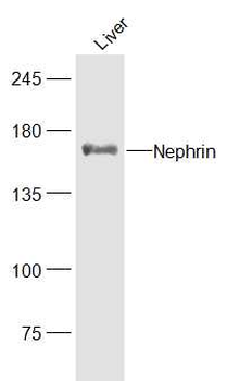 Nephrin Rabbit Polyclonal Antibody