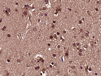 HES1 Rabbit Polyclonal Antibody