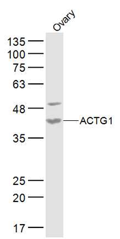 ACTG1 Rabbit Polyclonal Antibody