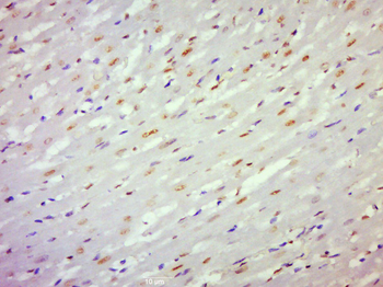 CKS2 Rabbit Polyclonal Antibody