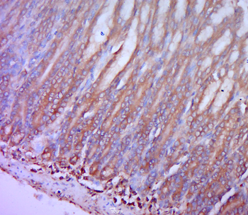 CCR-2 Rabbit Polyclonal Antibody