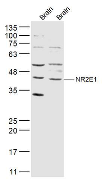 NR2E1 Rabbit Polyclonal Antibody
