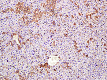 G-CSF Mouse Monoclonal Antibody