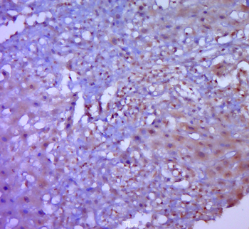 NOTCH3 Mouse Monoclonal Antibody