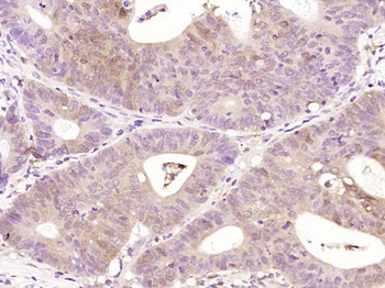 Bcl-2 Mouse Monoclonal Antibody