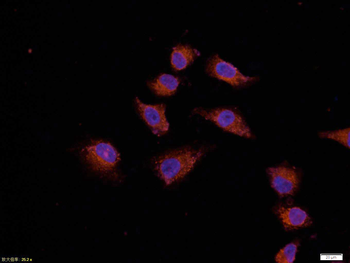 Bcl-2 Mouse Monoclonal Antibody