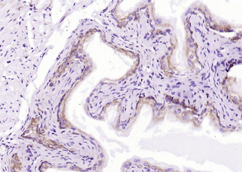 SGK1 Mouse Monoclonal Antibody
