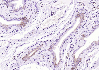 SGK1 Mouse Monoclonal Antibody