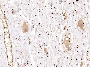 NF kB P65 (Acetyl-Lys314/Lys315) Mouse Monoclonal Antibody