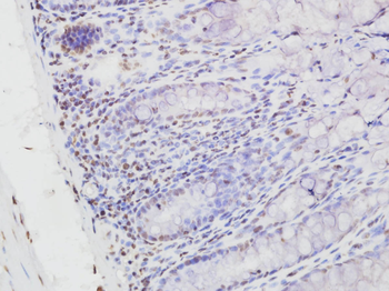 NF kB P65 (Acetyl-Lys314/Lys315) Mouse Monoclonal Antibody