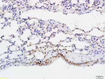 NF kB P65 (Acetyl-Lys314/Lys315) Mouse Monoclonal Antibody