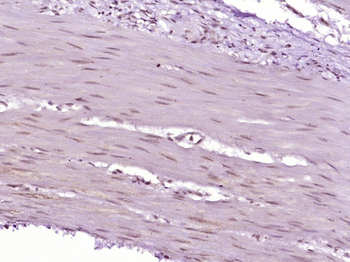 STAT1 Mouse Monoclonal Antibody