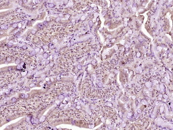 STAT1 Mouse Monoclonal Antibody