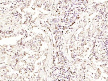 Smad3 Mouse Monoclonal Antibody