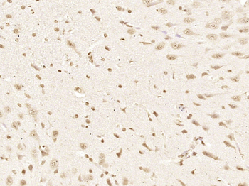 Smad3 Mouse Monoclonal Antibody