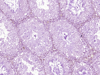 HP1 gamma Mouse Monoclonal Antibody