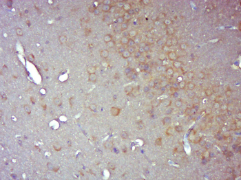 STAT1 Mouse Monoclonal Antibody