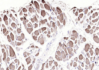 Myoglobin Mouse Monoclonal Antibody