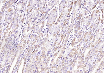 ASNS Rabbit Polyclonal Antibody