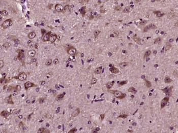 ASNS Rabbit Polyclonal Antibody