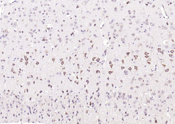 ASNS Rabbit Polyclonal Antibody