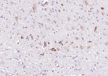 ASNS Rabbit Polyclonal Antibody