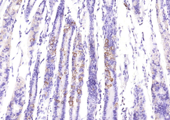 ASNS Rabbit Polyclonal Antibody