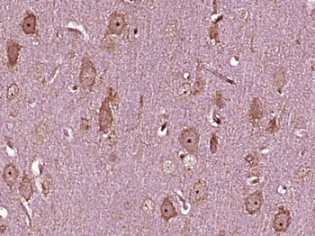 ASNS Rabbit Polyclonal Antibody