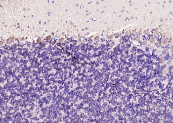 ASNS Rabbit Polyclonal Antibody
