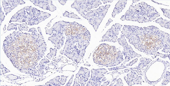 ASNS Rabbit Polyclonal Antibody