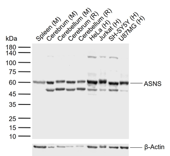 ASNS Rabbit Polyclonal Antibody
