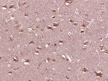 EXOC3L2 Rabbit Polyclonal Antibody