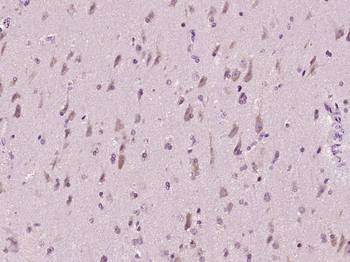 Caveolin-3 Rabbit Polyclonal Antibody