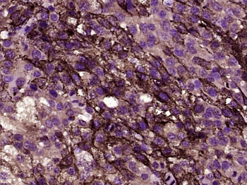 NG2 Rabbit Polyclonal Antibody