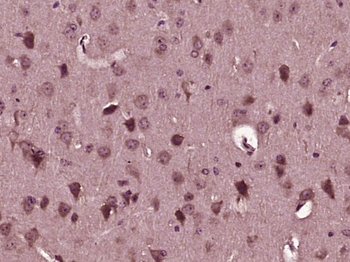 SBNO2 Rabbit Polyclonal Antibody